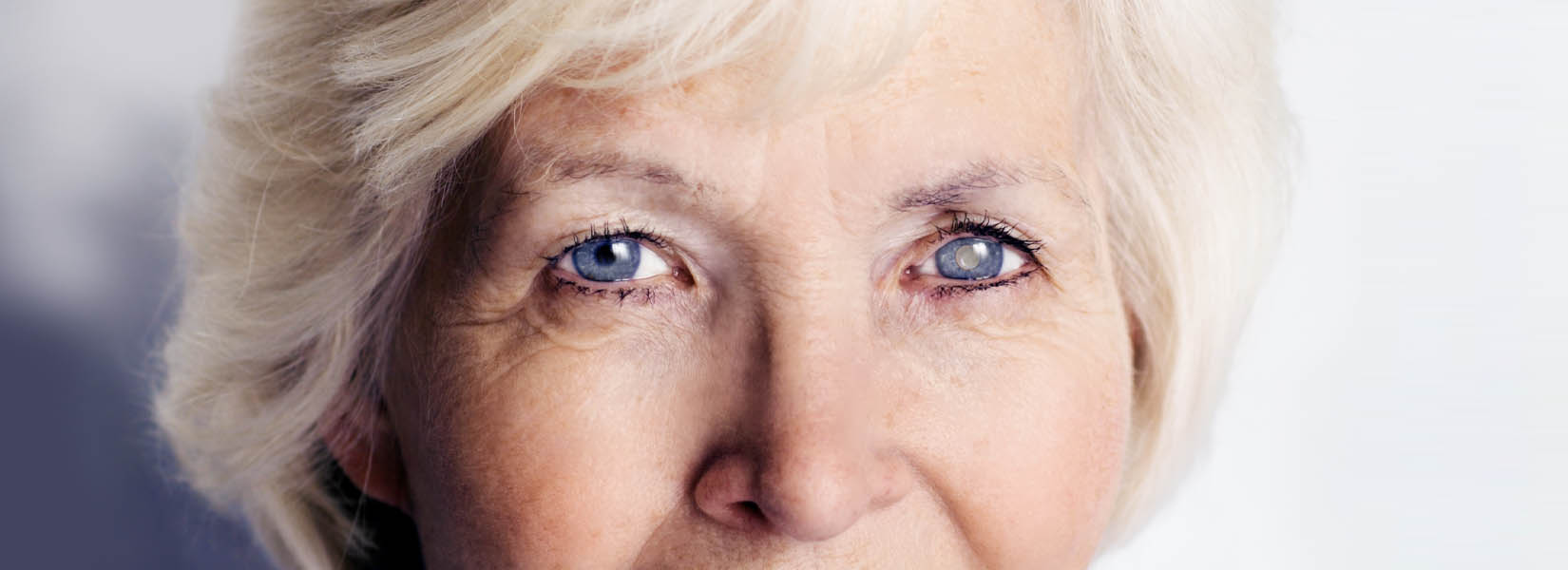 Cataract Surgery in Alamosa